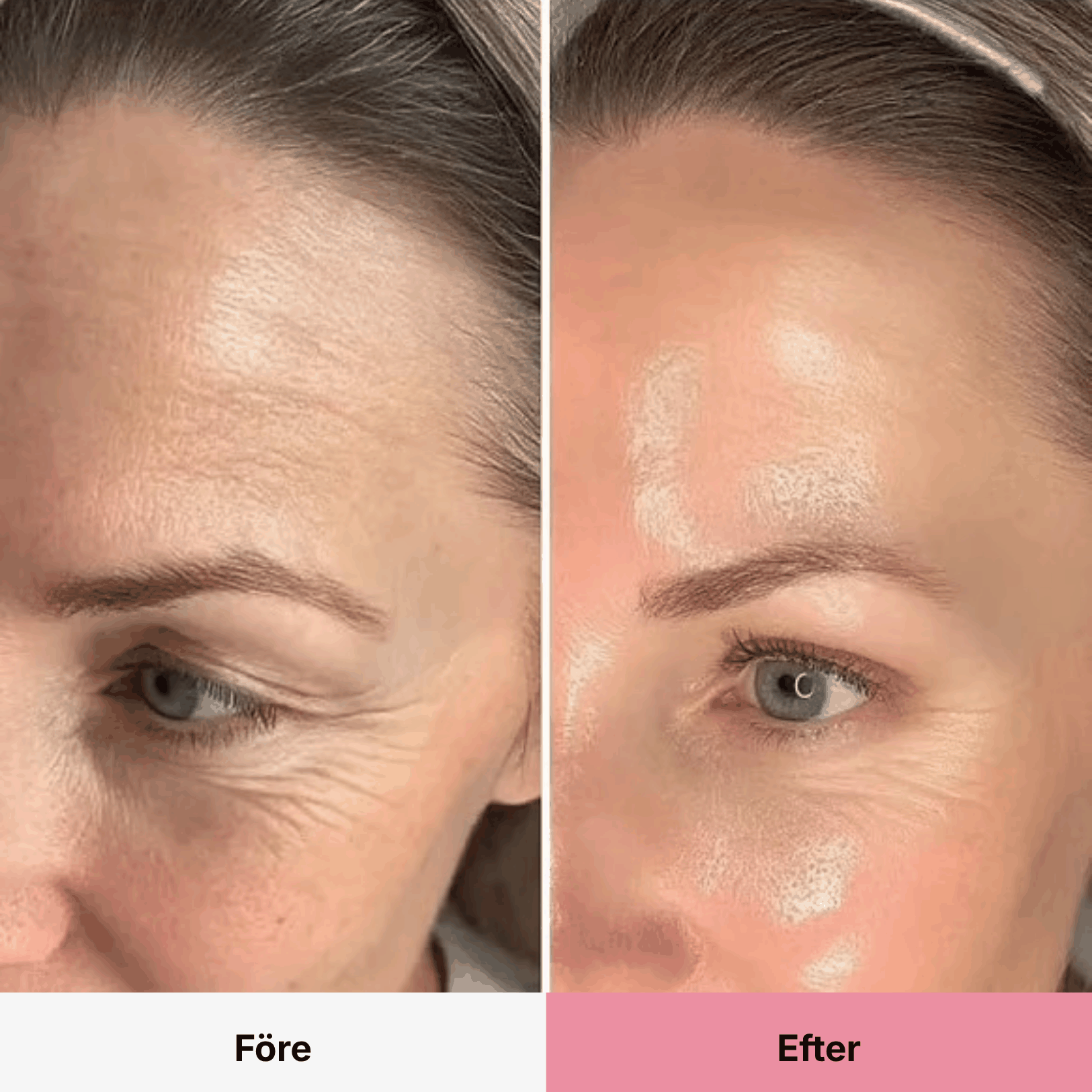 PDRN Collagen Volume Balm 4 RITUEL
