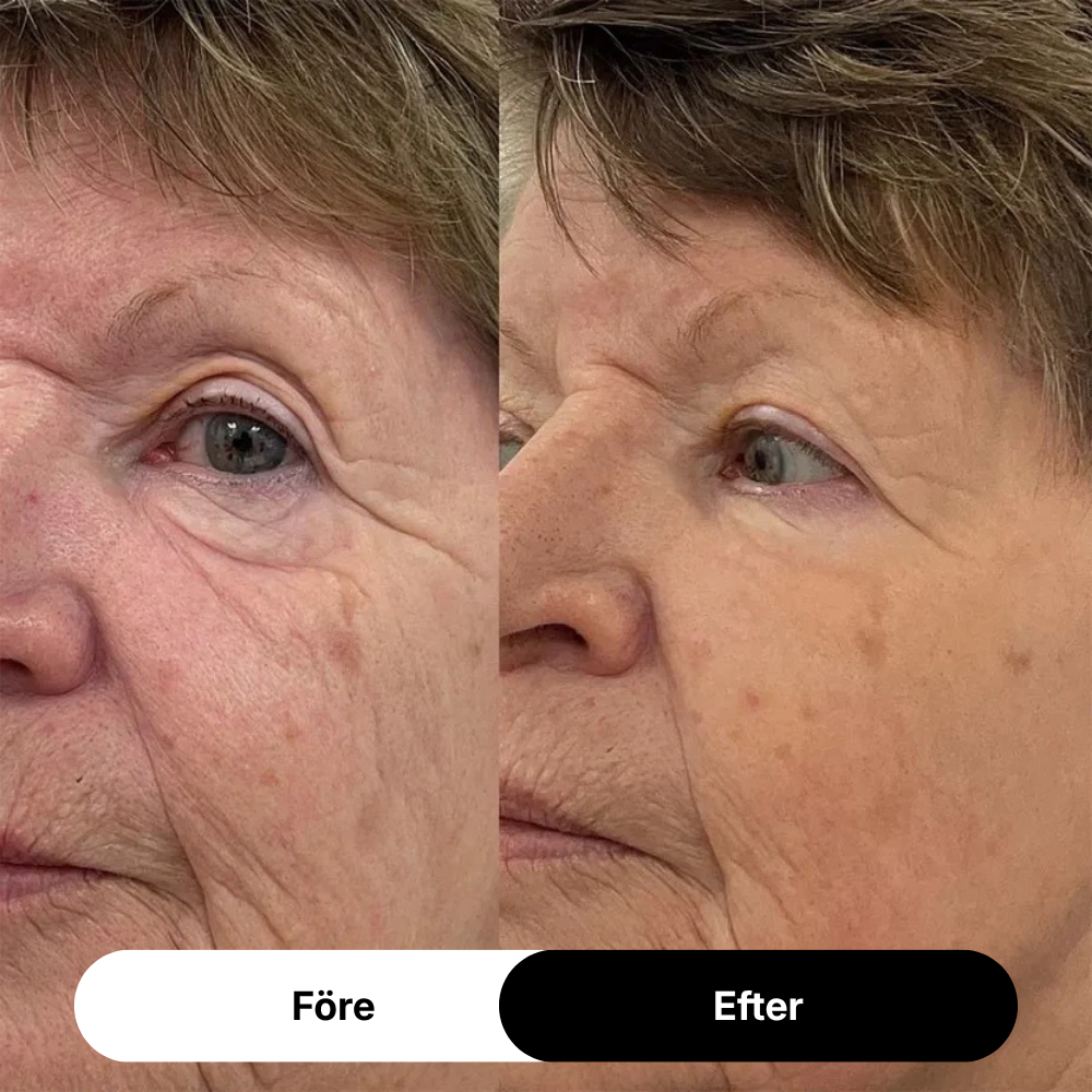 NAD+ EGF Firming Serum