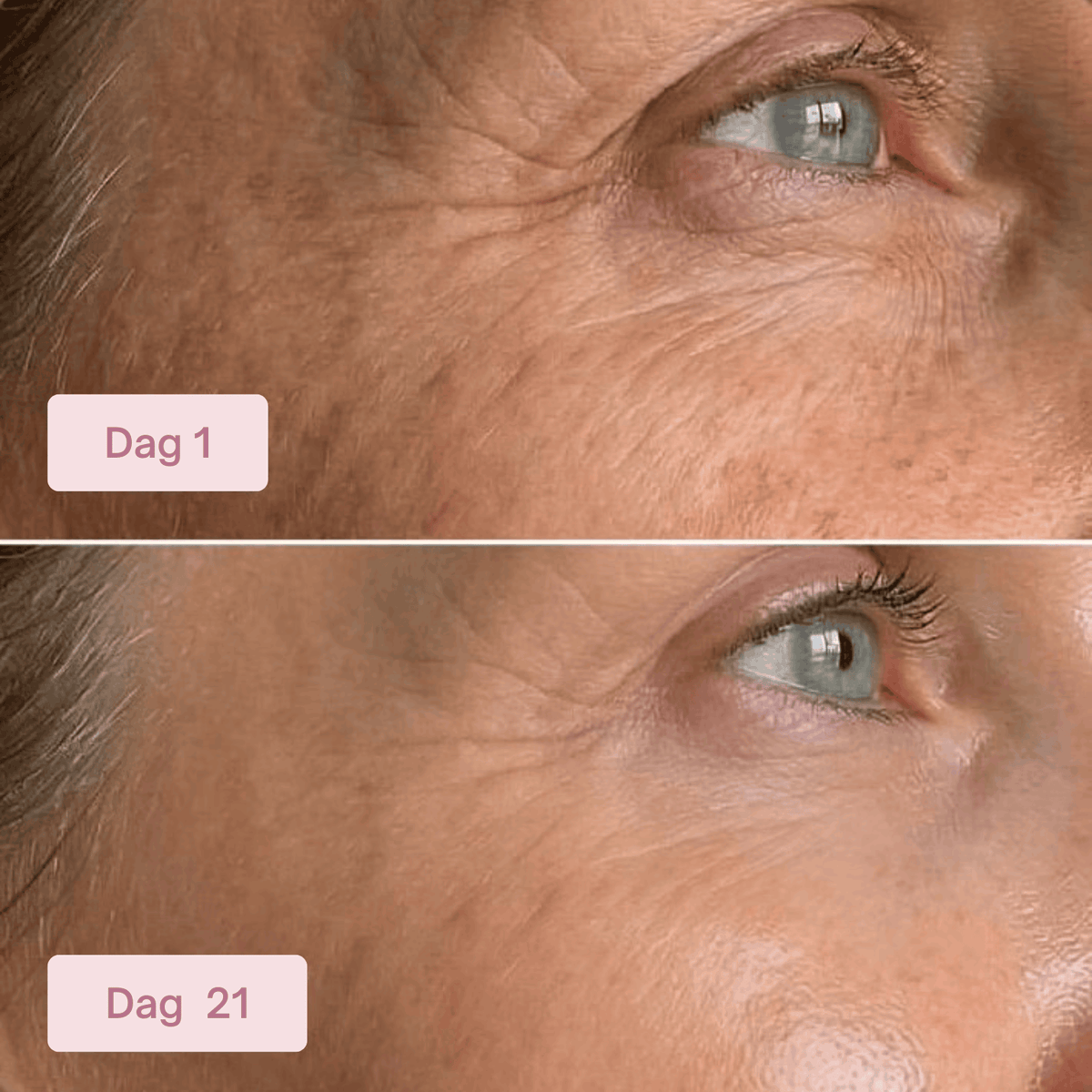 PDRN Collagen Eye Patches RITÚEL