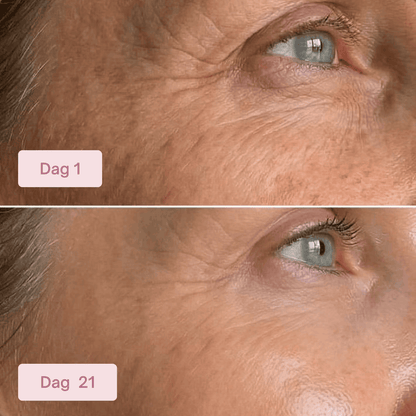 PDRN Collagen Eye Patches RITÚEL