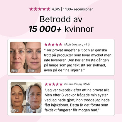 before-after
